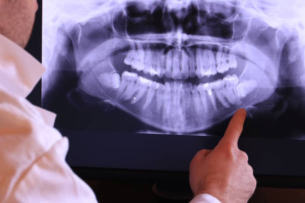 Best Emergency Dental Care for Broken or Chipped Teeth in Clendenin, WV