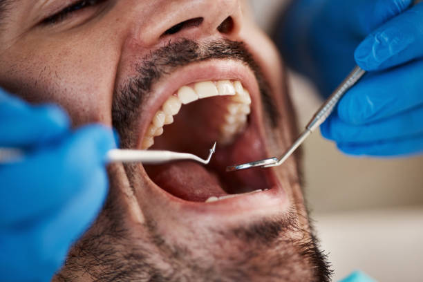 Best Emergency Root Canal Treatment in Clendenin, WV